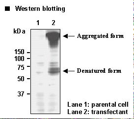 SLC6A3 / Dopamine Transporter Antibody