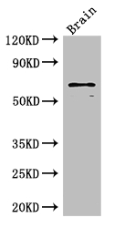 SLC6A3 / Dopamine Transporter Antibody - Positive WB detected in:Mouse brain tissue;All lanes: SLC6A3 antibody at 3ug/ml;Secondary;Goat polyclonal to rabbit IgG at 1/50000 dilution;Predicted band size: 69 kDa;Observed band size: 69 kDa;