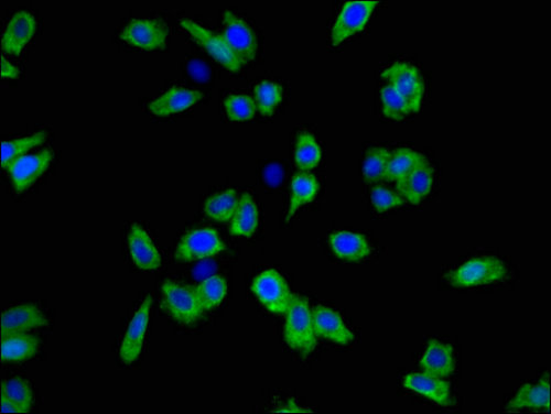 SLC6A3 / Dopamine Transporter Antibody - Immunofluorescent analysis of HepG2 cells using SLC6A3 Antibody at a dilution of 1:100 and Alexa Fluor 488-congugated AffiniPure Goat Anti-Rabbit IgG(H+L)