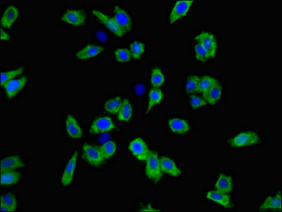 SLC6A3 / Dopamine Transporter Antibody - Immunofluorescent analysis of HepG2 cells using SLC6A3 Antibody at dilution of 1:100 and Alexa Fluor 488-congugated AffiniPure Goat Anti-Rabbit IgG(H+L)