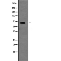 SLC6A3 / Dopamine Transporter Antibody - Western blot analysis of SLC6A3 expression in HEK293 cells. The lane on the left is treated with the antigen-specific peptide.