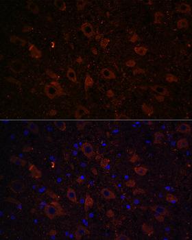 SLC6A3 / Dopamine Transporter Antibody - Immunofluorescence analysis of Rat brain using SLC6A3 Polyclonal Antibody at dilution of 1:100 (40x lens).Blue: DAPI for nuclear staining.
