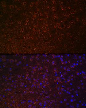SLC6A3 / Dopamine Transporter Antibody - Immunofluorescence analysis of Mouse brain using SLC6A3 Polyclonal Antibody at dilution of 1:100 (40x lens).Blue: DAPI for nuclear staining.