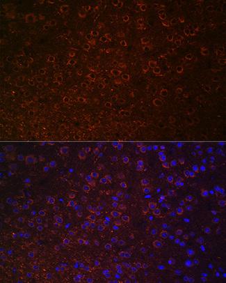 Anti-slc6a3   Dopamine Transporter Antibody 