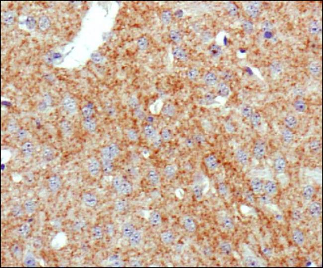 SLC6A3 / Dopamine Transporter Antibody - Immunohistochemistry-Paraffin: DAT1 Antibody (mAb16) - IHC analysis of DAT1 in mouse brain using DAB with hematoxylin counterstain.  This image was taken for the unconjugated form of this product. Other forms have not been tested.
