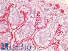 SLC6A4 / SERT Antibody - Human Small Intestine: Formalin-Fixed, Paraffin-Embedded (FFPE)