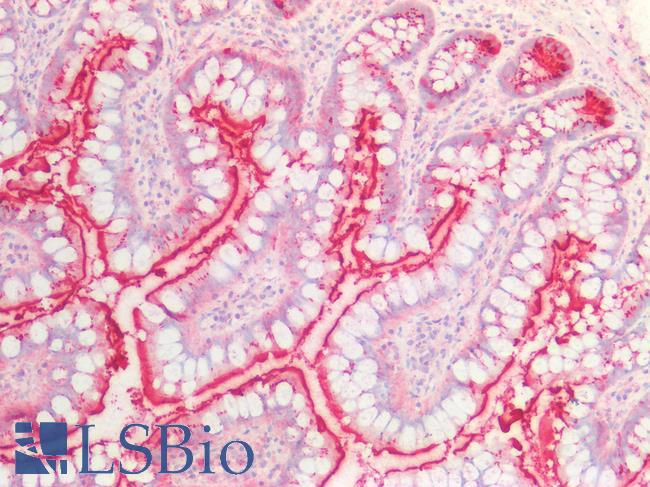 SLC6A4 / SERT Antibody - Human Small Intestine: Formalin-Fixed, Paraffin-Embedded (FFPE)
