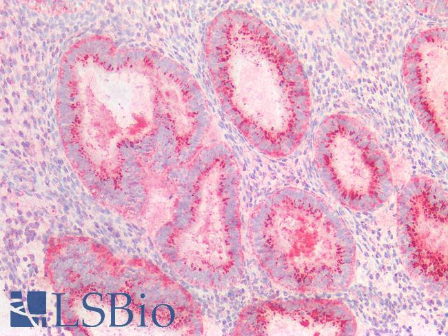 SLC6A4 / SERT Antibody - Human Uterus: Formalin-Fixed, Paraffin-Embedded (FFPE)