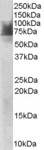 SLC6A4 / SERT Antibody - Antibody staining (1 ug/ml) of Human Duodenum lysate (RIPA buffer, 30 ug total protein per lane). Primary incubated for 1 hour. Detected by Western blot of chemiluminescence.