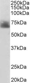 SLC6A4 / SERT Antibody - SLC6A4 / SERT antibody (2µg/ml) staining of Human Colon lysate (35µg protein in RIPA buffer). Detected by chemiluminescence.
