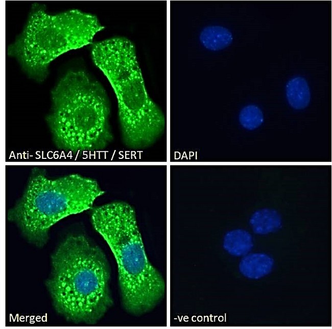 SLC6A4 / SERT Antibody - SLC6A4 / 5HTT / SERT Antibody Immunofluorescence analysis of paraformaldehyde fixed HepG2 cells, permeabilized with 0.15% Triton. Primary incubation 1hr (10ug/ml) followed by Alexa Fluor 488 secondary antibody (2ug/ml), showing vesicle staining. The nuclear stain is DAPI (blue). Negative control: Unimmunized goat IgG (10ug/ml) followed by Alexa Fluor 488 secondary antibody (2ug/ml).