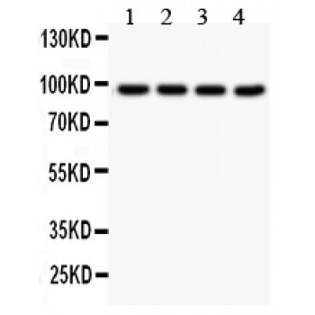SLC6A4 / SERT Antibody - SLC6A4 antibody Western blot. All lanes: Anti SLC6A4 at 0.5 ug/ml. Lane 1: A549 Whole Cell Lysate at 40 ug. Lane 2: MM231 Whole Cell Lysate at 40 ug. Lane 3: HELA Whole Cell Lysate at 40 ug. Lane 4: 22RV1 Whole Cell Lysate at 40 ug. Predicted band size: 70 kD. Observed band size: 95 kD.