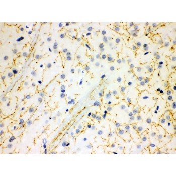 SLC6A4 / SERT Antibody - SLC6A4 antibody IHC-paraffin. IHC(P): Rat Brain Tissue.