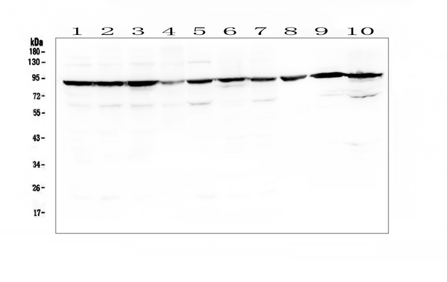 SLC6A4 / SERT Antibody - Western blot analysis of SLC6A4 using anti-SLC6A4 antibody. Electrophoresis was performed on a 5-20% SDS-PAGE gel at 70V (Stacking gel) / 90V (Resolving gel) for 2-3 hours. The sample well of each lane was loaded with 50ug of sample under reducing conditions. Lane 1: human HepG whole cell lysates, Lane 2: human Caco-2 whole cell lysates, Lane 3: human SW620 whole cell lysates, Lane 4: human COLO-320 whole cell lysates. Lane 5: human K562 whole cell lysates, Lane 6: human U2OS whole cell lysates, Lane 7: human U-87MG whole cell lysates, Lane 8: rat heart tissue lysates, Lane 9: mouse heart tissue lysates, Lane 10: mouse SP20 whole cell lysates. After Electrophoresis, proteins were transferred to a Nitrocellulose membrane at 150mA for 50-90 minutes. Blocked the membrane with 5% Non-fat Milk/ TBS for 1.5 hour at RT. The membrane was incubated with rabbit anti-SLC6A4 antigen affinity purified polyclonal antibody at 0.5 µg/mL overnight at 4°C, then washed with TBS-0.1% Tween 3 times with 5 minutes each and probed with a goat anti-rabbit IgG-HRP secondary antibody at a dilution of 1:10000 for 1.5 hour at RT. The signal is developed using an Enhanced Chemiluminescent detection (ECL) kit with Tanon 5200 system. A specific band was detected for SLC6A4 at approximately 90KD. The expected band size for SLC6A4 is at 70KD.