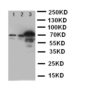 SLC6A4 / SERT Antibody - WB of SLC6A4 / SERT antibody. Lane 1: U87 Cell Lysate. Lane 2: HELA Cell Lysate. Lane 3: JURKAT Cell Lysate.