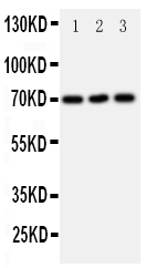 SLC6A4 / SERT Antibody - Anti-SLC6A4 antibody, Western blotting All lanes: Anti SLC6A4 at 0.5ug/ml Lane 1: U87 Whole Cell Lysate at 40ug Lane 2: HELA Whole Cell Lysate at 40ug Lane 3: JURKAT Whole Cell Lysate at 40ug Predicted bind size: 70KD Observed bind size: 70KD