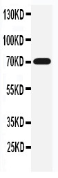 SLC6A4 / SERT Antibody - WB of SLC6A4 / SERT antibody. All lanes: Anti-SLC6A4 at 0.5ug/ml. WB: Rat Brain Tissue Lysate at 40ug. Predicted bind size: 70KD. Observed bind size: 70KD.