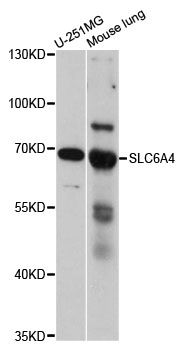SLC6A4 / SERT Antibody - Western blot analysis of extracts of various cell lines, using SLC6A4 antibody at 1:1000 dilution. The secondary antibody used was an HRP Goat Anti-Rabbit IgG (H+L) at 1:10000 dilution. Lysates were loaded 25ug per lane and 3% nonfat dry milk in TBST was used for blocking. An ECL Kit was used for detection and the exposure time was 90s.