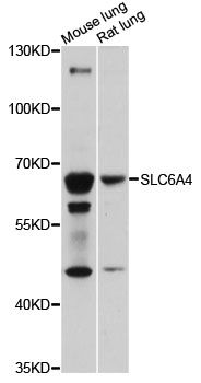 SLC6A4 / SERT Antibody - Western blot analysis of extracts of various cell lines, using SLC6A4 antibody at 1:1000 dilution. The secondary antibody used was an HRP Goat Anti-Rabbit IgG (H+L) at 1:10000 dilution. Lysates were loaded 25ug per lane and 3% nonfat dry milk in TBST was used for blocking. An ECL Kit was used for detection and the exposure time was 30s.