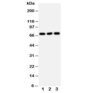 SLC6A4 / SERT Antibody - Western blot testing of SERT antibody and Lane 1: U87; 2: HeLa; 3: Jurkat cell lysate. Expected molecular weight: ~70/85-95kDa (unmodified/glycosylated).
