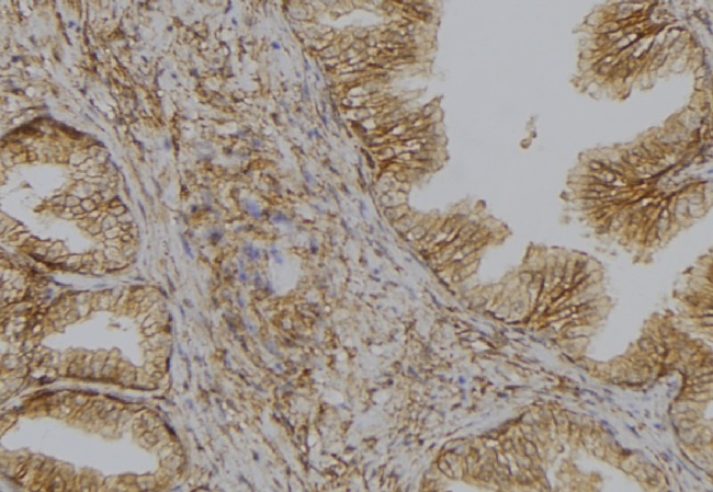 SLC6A4 / SERT Antibody - 1:100 staining mouse colon tissue by IHC-P. The sample was formaldehyde fixed and a heat mediated antigen retrieval step in citrate buffer was performed. The sample was then blocked and incubated with the antibody for 1.5 hours at 22°C. An HRP conjugated goat anti-rabbit antibody was used as the secondary.