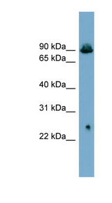 SLC6A5 / GLYT2 Antibody - SLC6A5 / GLYT2 antibody Western blot of PANC1 cell lysate. This image was taken for the unconjugated form of this product. Other forms have not been tested.