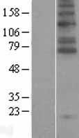 SLC6A5 / GLYT2 Protein - Western validation with an anti-DDK antibody * L: Control HEK293 lysate R: Over-expression lysate
