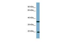 SLC6A6 / Taurine Transporter Antibody - Western blot analysis using Anti-SLC6A6 Antibody on PANC1 whole cell lysates at a dilution of 1ug/ml.  This image was taken for the unconjugated form of this product. Other forms have not been tested.