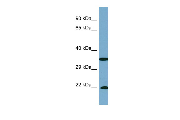 SLC6A6 / Taurine Transporter Antibody - Western blot analysis using Anti-SLC6A6 Antibody on PANC1 whole cell lysates at a dilution of 1ug/ml.  This image was taken for the unconjugated form of this product. Other forms have not been tested.