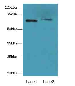 SLC6A6 / Taurine Transporter Antibody - Western blot. All lanes: SLC6A6 antibody at 0.5 ug/ml. Lane 1: Human placenta tissue. Lane 2: HeLa whole cell lysate. Secondary Goat polyclonal to Rabbit IgG at 1:10000 dilution. Predicted band size: 70 kDa. Observed band size: 70 kDa.