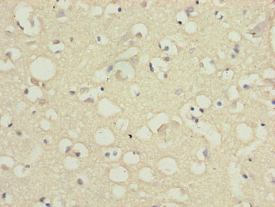 SLC6A6 / Taurine Transporter Antibody - Immunohistochemistry of paraffin-embedded human brain tissue using SLC6A6 Antibody at dilution of 1:100
