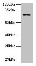SLC6A6 / Taurine Transporter Antibody - Western blot All lanes: SLC6A6 antibody at 0.5µg/ml Lane 1: Human placenta tissue Lane 2: Hela whole cell lysate Secondary Goat polyclonal to rabbit IgG at 1/10000 dilution Predicted band size: 70, 23 kDa Observed band size: 70 kDa