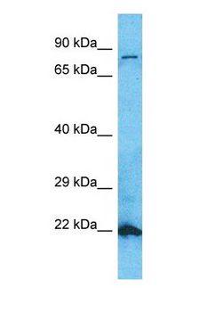 SLC6A6 / Taurine Transporter Antibody - Western blot of SC6A6 Antibody with human Fetal Lung lysate.  This image was taken for the unconjugated form of this product. Other forms have not been tested.