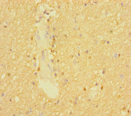 SLC6A7 Antibody - Immunohistochemistry of paraffin-embedded human brain tissue using SLC6A7 Antibody at dilution of 1:100