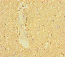 SLC6A7 Antibody - Immunohistochemistry of paraffin-embedded human brain tissue using SLC6A7 Antibody at dilution of 1:100