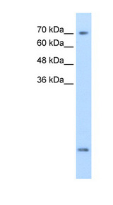 SLC6A8 Antibody - SLC6A8 antibody ARP42248_T100-NP_005620-SLC6A8(solute carrier family 6 (neurotransmitter transporter, creatine), member 8) Antibody Western blot of MDA-MB-435S cell lysate.  This image was taken for the unconjugated form of this product. Other forms have not been tested.