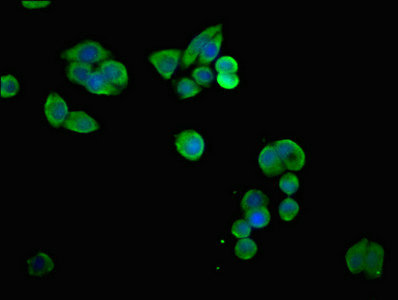 SLC6A8 Antibody - Immunofluorescent analysis of PC3 cells at a dilution of 1:100 and Alexa Fluor 488-congugated AffiniPure Goat Anti-Rabbit IgG(H+L)