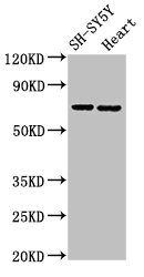 SLC6A8 Antibody - Positive Western Blot detected in SH-SY5Y whole cell lysate, Mouse heart tissue. All lanes: SLC6A8 antibody at 2 µg/ml Secondary Goat polyclonal to rabbit IgG at 1/50000 dilution. Predicted band size: 71, 81, 31, 59 KDa. Observed band size: 71 KDa