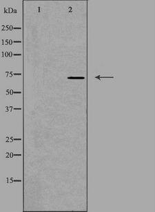 SLC6A8 Antibody - Western blot analysis of extracts of HuvEc cells using SLC6A8 antibody. The lane on the left is treated with the antigen-specific peptide.