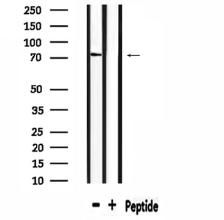 SLC6A8 Antibody - Western blot analysis of extracts of mouse brain tissue using SLC6A8 antibody.