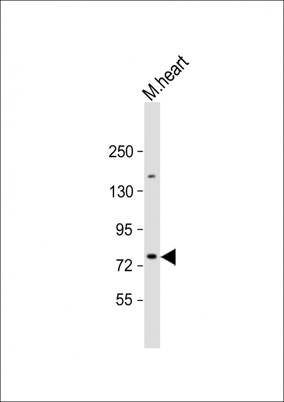 SLC6A8 Antibody - Anti-SLC6A8 Antibody (N-Term) at 1:2000 dilution + mouse heart lysate Lysates/proteins at 20 µg per lane. Secondary Goat Anti-Rabbit IgG, (H+L), Peroxidase conjugated at 1/10000 dilution. Predicted band size: 71 kDa Blocking/Dilution buffer: 5% NFDM/TBST.