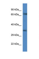 SLC6A9 / GLYT1 Antibody - SLC6A9 / GLYT1 antibody Western blot of Mouse Spleen lysate. Antibody concentration 1 ug/ml. This image was taken for the unconjugated form of this product. Other forms have not been tested.