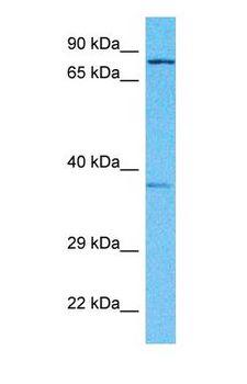 SLC6A9 / GLYT1 Antibody - Western blot of SC6A9 Antibody with human Fetal Lung lysate.  This image was taken for the unconjugated form of this product. Other forms have not been tested.