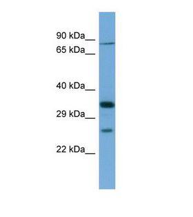SLC6A9 / GLYT1 Antibody - Western blot of Human THP-1. SLC6A9 antibody dilution 1.0 ug/ml.  This image was taken for the unconjugated form of this product. Other forms have not been tested.