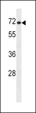 SLC7A1 / CAT1 Antibody - SLC7A1 Antibody western blot of NCI-H460 cell line lysates (35 ug/lane). The SLC7A1 antibody detected the SLC7A1 protein (arrow).