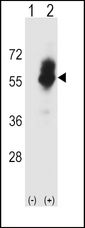 SLC7A1 / CAT1 Antibody - Western blot of SLC7A1 (arrow) using rabbit polyclonal SLC7A1 Antibody. 293 cell lysates (2 ug/lane) either nontransfected (Lane 1) or transiently transfected (Lane 2) with the SLC7A1 gene.
