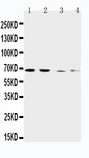 SLC7A1 / CAT1 Antibody - WB of SLC7A1 / ERR antibody. Lane 1: Human Placenta Tissue Lysate. Lane 2: HELA Cell Lysate. Lane 3: SKOV-3 Cell Lysate. Lane 4: HT1080 Cell Lysate.