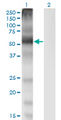SLC7A1 / CAT1 Antibody - Western Blot analysis of SLC7A1 expression in transfected 293T cell line by SLC7A1 monoclonal antibody (M02), clone 2B9.Lane 1: SLC7A1 transfected lysate (Predicted MW: 67.6 KDa).Lane 2: Non-transfected lysate.