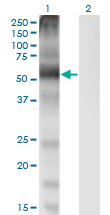 SLC7A1 / CAT1 Antibody - Western Blot analysis of SLC7A1 expression in transfected 293T cell line by SLC7A1 monoclonal antibody (M02), clone 2B9.Lane 1: SLC7A1 transfected lysate (Predicted MW: 67.6 KDa).Lane 2: Non-transfected lysate.