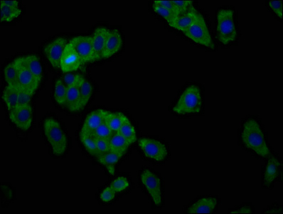 SLC7A1 / CAT1 Antibody - Immunofluorescence staining of HepG2 cells at a dilution of 1:166, counter-stained with DAPI. The cells were fixed in 4% formaldehyde, permeabilized using 0.2% Triton X-100 and blocked in 10% normal Goat Serum. The cells were then incubated with the antibody overnight at 4 °C.The secondary antibody was Alexa Fluor 488-congugated AffiniPure Goat Anti-Rabbit IgG (H+L) .